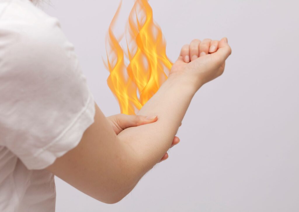 Burning forearm